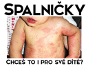 Spalničky